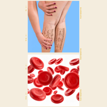 Photo de jambes avec circulation 